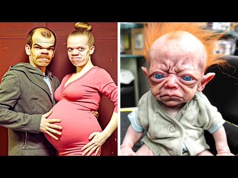 They Were Warned Not to Have Children, but They Didn&#039;t Heed - Most Unusual Births in the World